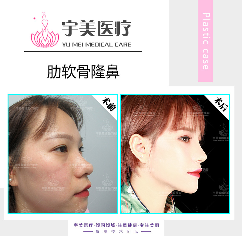 深圳宇美醫療提供優良整形美容